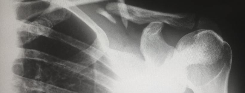 Sports therapy rehab